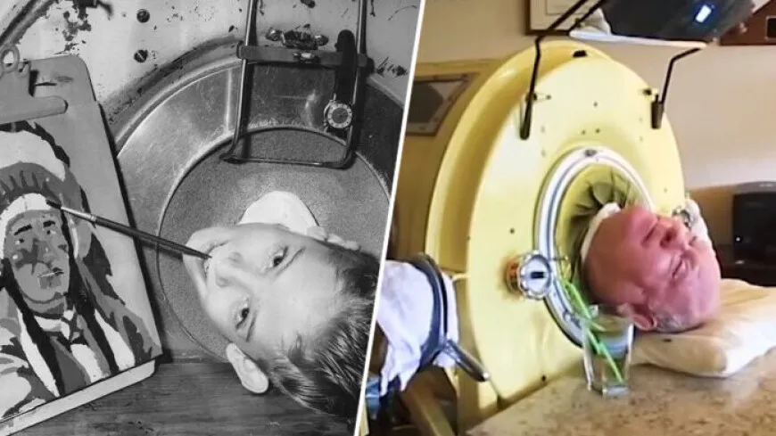 Paul Alexander, 78-year-old Dallas man who lived in an iron lung for most of his life, dies